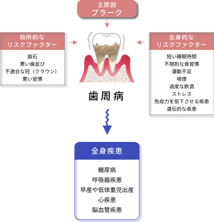 歯周病の原因